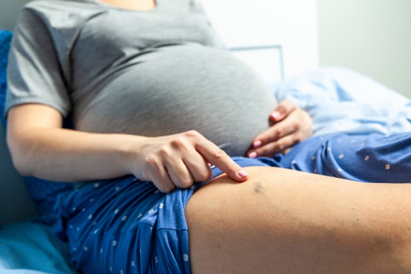 நீங்க கர்ப்பிணியா? இந்த நேரத்தில் ஆபத்தான வெரிகோஸ் வெயின் வரும்!  எச்சரிக்கை அறிகுறிகள் | Pregnancy Varicose Veins Symptoms