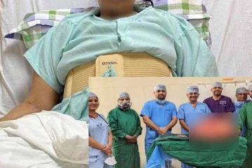 47 கிலோ கட்டியோடு 18 வருடம் வாழ்ந்து வந்த பெண்! இந்தியாவில் மருத்துவர்கள் படைத்த சாதனை