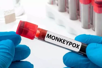 கனடாவில் எகிறும் குரங்கம்மை தொற்று!  ஆயிரத்தை கடந்த எண்ணிக்கை