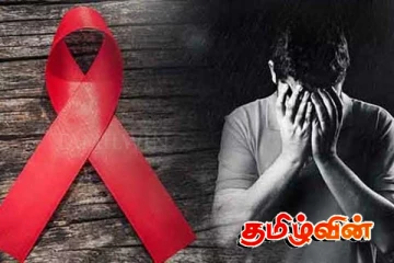 இலங்கையில் எயிட்ஸ் நோய் பரவல் தொடர்பில் சர்வதேச எச்சரிக்கை