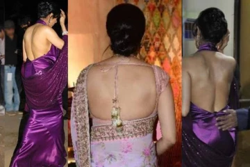 29 அறுவை சிகிச்சைகள் செய்துகொண்ட லேடி சூப்பர்ஸ்டார் - அதுவும் அழகுக்காக..