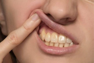 2 நிமிடத்தில் மஞ்சள் படிந்த பற்களை வெள்ளையாக்குவது எப்படி? எளிய வழிமுறை இதோ