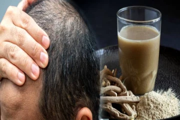 வழுக்கை தலையில் முடி வளர வைக்கும் ஆயுர்வேத வைத்தியம்- கவலைய விடுங்க