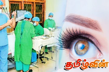 பொசன் தினத்தில் இலவச கண் சத்திர சிகிச்சை