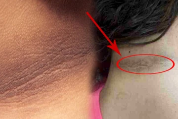 உங்களது கழுத்து கருப்பா அசிங்கமா இருக்கா? இதனை எப்படி எளிய முறையில் போக்கலாம்?