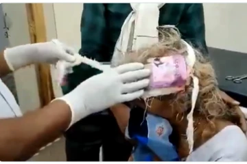 ஆணுறையை வைத்து தலையில் கட்டுப்போட்ட கொடுமை - அலட்சியத்தில் மருத்துவமனை!