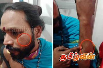 கிளிநொச்சியில் மதகுரு ஒருவர் மீது தாக்குதல்