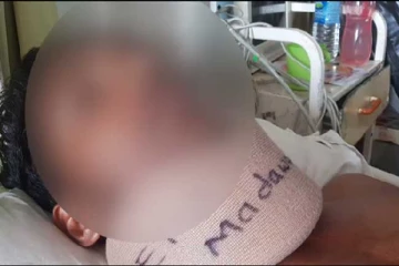 காவல்துறையின் மோசமான தாக்குதல் : உடல் உறுப்பை இழந்தார் இளைஞன்