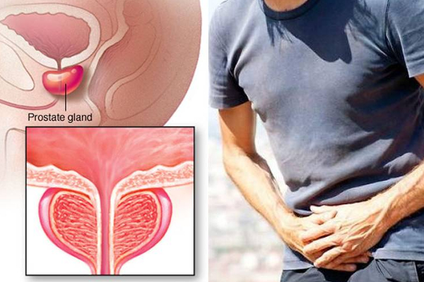 ஆண்களுக்கான எச்சரிக்கை! அவதானமாக இருங்கள்-இல்லையேல் பேராபத்தை ஏற்படுத்தும் - ஐபிசி தமிழ்