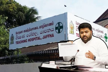 சிகிச்சை பெறச் சென்ற சிறுமியின் கை அகற்றப்பட்ட சம்பவம்: நீதி கோரும் அங்கஜன் எம்.பி