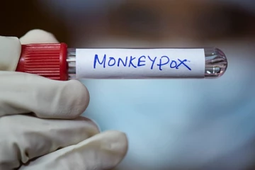 சீனாவில் முதல் முறையாக கால் பதித்த குரங்கு அம்மை!