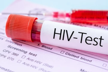 இலங்கையில் அதிகரிக்கும் HIV தொற்றாளர்கள் ; போதைப்பொருளால் வேகமெடுக்கும் ஆபத்து