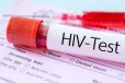 இலங்கையில் அதிகரிக்கும் HIV தொற்றாளர்கள் ; போதைப்பொருளால் வேகமெடுக்கும் ஆபத்து