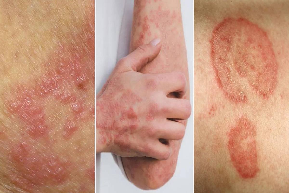 நாட்டில் கடும் வெப்பமான காலநிலை : சிறுவர்களுக்கு விடுக்கப்பட்ட எச்சரிக்கை! | Severely Hot Weather In The Country Children