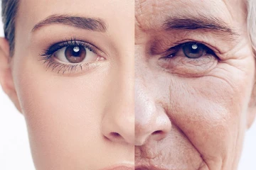 சுருக்கம் வர தொடங்கிடுச்சா..? இத மட்டும் செய்து பாருங்க போதும்!