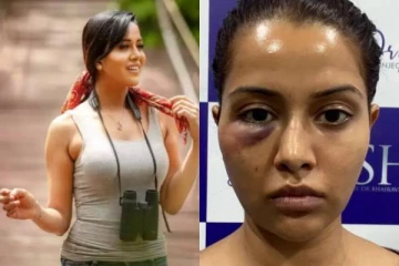 முகத்திற்கு ஃபேசியல் செய்ய போன இடத்தில் பிரபல நடிகை ரைசாவிற்கு நடந்த விபரீதம்! வெளியான அதிர்ச்சி புகைப்படம்