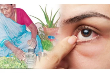 கண்கட்டி உங்களை பாடாய் படுத்துகிறதா? இதோ பாட்டி வைத்தியம்!