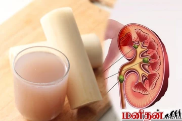 சிறுநீரகத்தில் கல்லடைப்பு பிரச்சனையா? நிரந்தர தீர்வு அளிக்கும் வாழைத்தண்டு