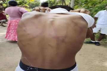 மாணவன் மீது கொடூர தாக்குதல் -ஆசிரியர் கைது (படங்கள்)
