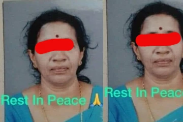 யாழில் வைத்தியசாலையில் மேற்கொள்ளப்பட்ட சத்திர சிகிச்சை தவறினால் பெண் உயிரிழப்பு