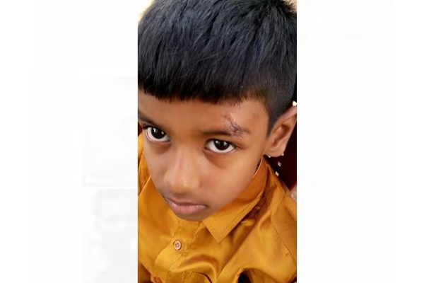 karnataka-doctor-used-feviquick-for-head-injury karnataka-doctor-used-feviquick-for-head-injury