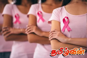 இலங்கையில் பெண்களிடையே அதிகரிக்கும் நோய்