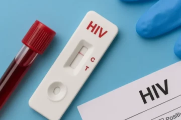 இலங்கையில் இளையோரிடம் அதிகரிக்கும் எயிட்ஸ் தொற்று!