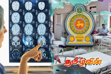 இரு வருடங்களாக அரச மருத்துவமனைகளில் நிலவும் கதிரியக்க வல்லுநர்கள் பற்றாக்குறை