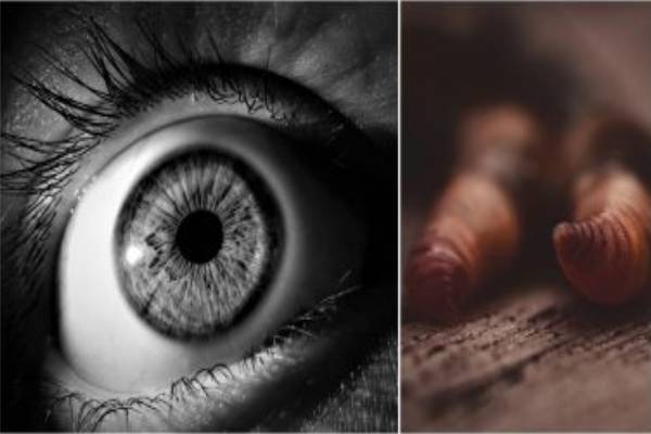 live-worms-in eyes