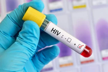 எயிட்ஸ் நோயின் அறிகுறிகள் என்ன? இதனை தடுப்பது எப்படி? வாங்க பார்க்கலாம்