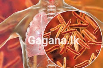 රටම බය කළ ඖෂධ තත්ත්ව පරීක්ෂාවෙන් හෙළිවූ දේ - ඖෂධ වල බැක්ටීරියා..!