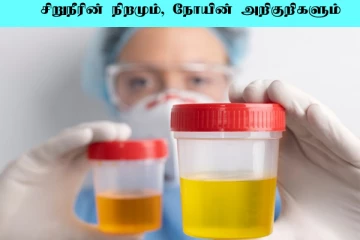 சிறுநீரின் நிறம் இப்படி இருக்கின்றதா? உடனே மருத்துவரை அணுகுங்கள்