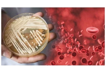 நேரடியாக ரத்த ஓட்டத்தை பாதித்து மரணத்தை கொடுக்கும் ‘கேண்டிடா ஆரிஸ்’ - புதிய பூஞ்சை கண்டுபிடிப்பு - அமெரிக்கா எச்சரிக்கை!