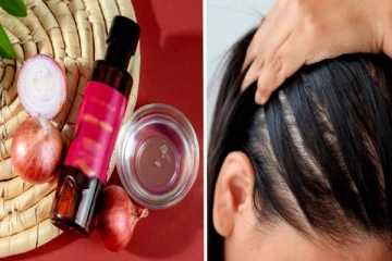 இந்த எண்ணெய் வாரத்துக்கு 2 முறை போடுங்க.. 7 நாளில் தலைமுடி உதிர்வுக்கு தீர்வு