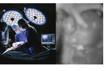 பெண்ணின் வயிற்றில் இருந்த 5 கிலோ கட்டி..அதிர்ந்து போன மருத்துவர்கள் - அறுவை சிகிச்சையில் நடந்த கொடூரம்!