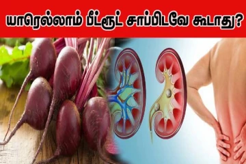 இந்த பிரச்சினைகள் இருக்கா? அப்போ பீட்ரூட்டை தவறியும் சாப்பிடாதீங்க