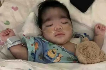 உடல் முழுவதும் முடி வளர்ந்து கொரில்லா போன்று மாறிவரும் குழந்தை: காரணம் என்ன?