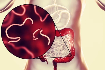 ஊசிப்புழுவால் வயிறு வலிக்குதா? இதனை போக்க சில எளிய வழிகள் இதோ