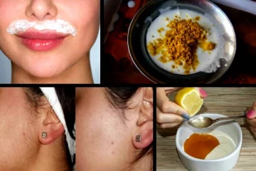 பளபளப்பான உங்க உங்க முகத்துல அசிங்கமா முடி வளருதா? அப்போ இத தினமும் தடவுங்க!