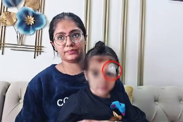 குழந்தையின் கண் அருகே காயம் - சிகிச்சைக்கு பதிலாக பசை மூலம் ஒட்டிய மருத்துவர் | Meerut Doctor Sealed Toddlers Wound By Fevikwik குழந்தையின் கண் அருகே காயம் - சிகிச்சைக்கு பதிலாக பசை மூலம் ஒட்டிய மருத்துவர் | Meerut Doctor Sealed Toddlers Wound By Fevikwik