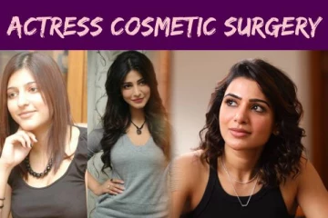 அழகுக்காக அறுவை சிகிச்சை செய்துகொண்ட பிரபல தமிழ் நடிகைகள் !