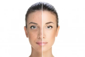 ඔබත් සුදු වෙන්න ආසද? එහෙනම් කවදාවත් මේ වැරැද්ද කරන්න එපා.