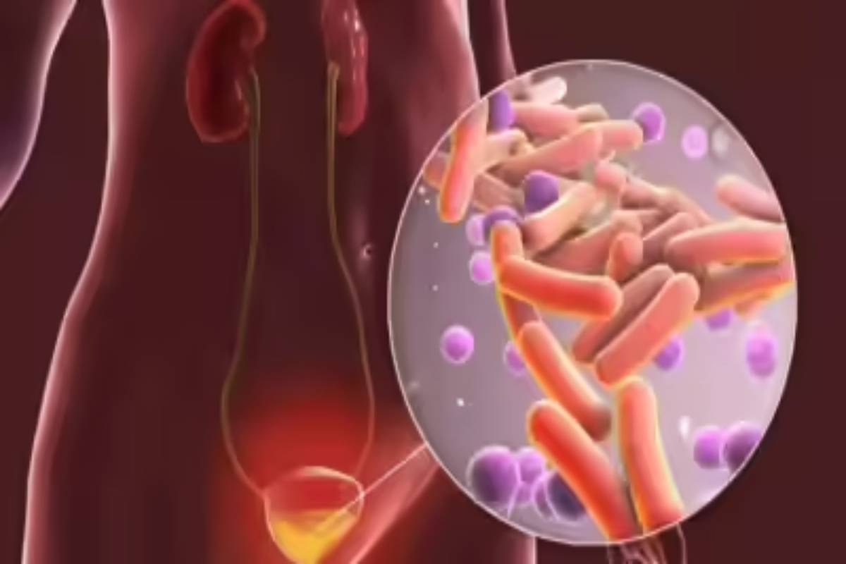 சிறுநீருடன் இரத்தம் வருகிறதா? அப்போ இந்த நோய் இருக்கு... ஜாக்கிரதை | Blood In Urine Sign Of Serious Disease