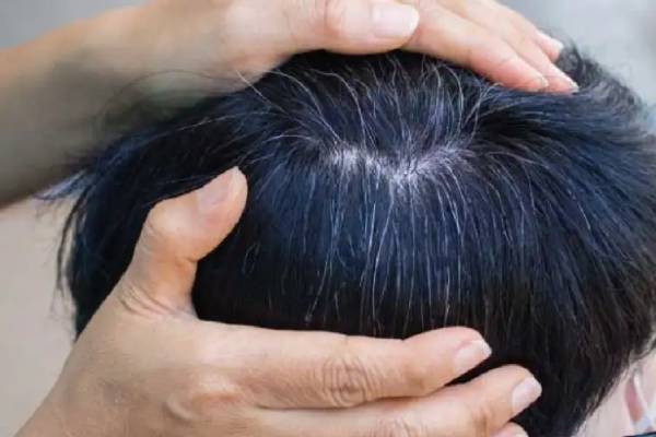 இளவயதில் தலை முடி நரைக்கிறதா...! இது மட்டும் இருந்தால் போதும் உடனடி பலன் | White Hair Black Hair Natural Remedy