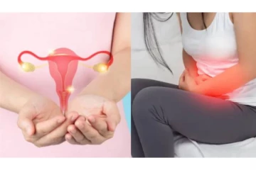 உங்களுக்கு PCOS பாதிப்பு இருக்கிறதா..?அப்போ இந்த உணவுகளை சாப்பிடாதீர்கள் - எச்சரிக்கை!