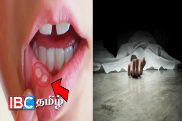 நாளாந்தம் இறக்கும் இலங்கையர் : வைத்தியர் வெளியிட்ட அதிர்ச்சி தகவல்