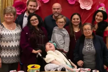 மூளையின் பெரும்பகுதி இல்லை; மருத்துவ உலகின் கணிப்பை பொய்யாக்கிய அமெரிக்க யுவதி!