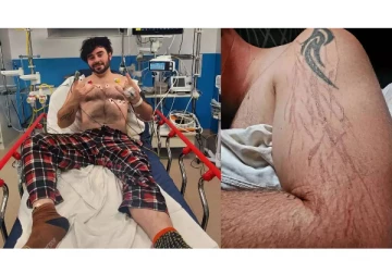 வீடியோ கேம் விளையாடி கொண்டிருந்த நபரை தாக்கிய மின்னல்! கையில் ஏற்பட்ட காயம்; நடந்தது என்ன?