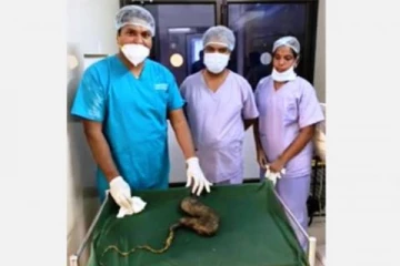 ஆன்லைன் வகுப்பால் மன சோர்வு! 15 வயது மாணவி வயிற்றில் 1 கிலோ எடையுள்ள முடிகளால் ஆன கட்டி அகற்றம்