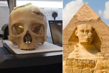 மண்டை ஓட்டில் இருந்த தடயம்; 4000 ஆண்டுகள் முன்னரே புற்றுநோய் சிகிச்சை - அதிர்ந்த ஆய்வாளர்கள்!